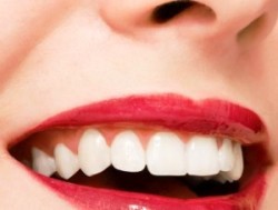 cibi che favoriscono denti bianchi